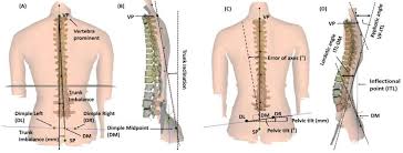 The veins of the upper portion of the back drain into the posterior intercostal veins, while lumbar veins from the lower portion of the back drain into the inferior vena cava. Medicina Free Full Text A Randomized Controlled Trial Investigating The Effects Of Equine Simulator Riding On Low Back Pain Morphological Changes And Trunk Musculature In Elderly Women