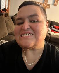 I've always been a little self-conscious about my teeth. I have a cavity