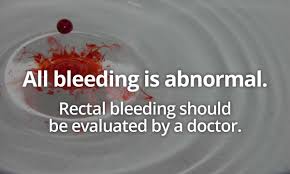 Samples of the stool are taken from the patient for laboratory testing to determine if there is blood in. Blood In Toilet Should I See A Doctor Kenneth Brown M D