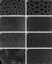 Image result for Pentas bussei