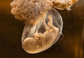 Die lage des embryos (auch bei zwillingen) im mutterleib und die qualität des gerätes machen die darstellung. Das Herzchen Schlagt Schon Fruher Factum Magazin