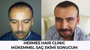 Hermes Sac Ekim
