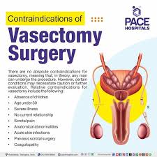 Image result for Vasectomy