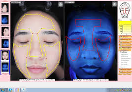 Nimue Skin Analyzer Vs Nimue Skin Analyzer Which Is Better