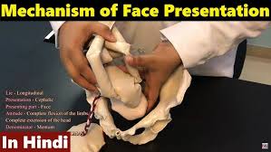 Image result for Compound Presentation