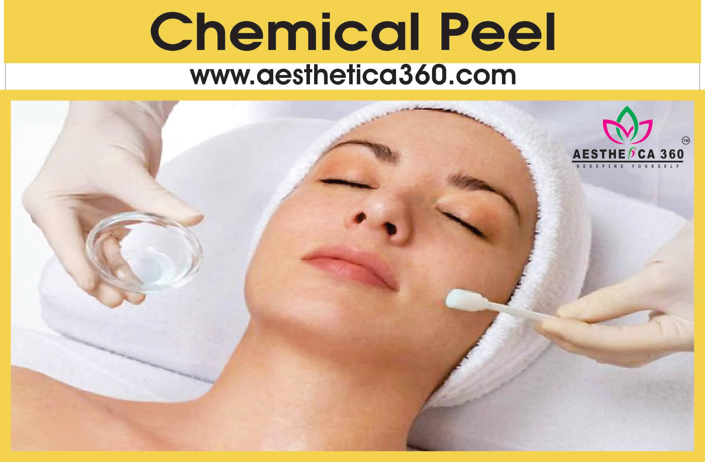 Chemical Peel product image