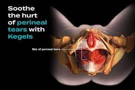 Healing the Pain of Perineal Tears: Tips for a Speedy Recovery - StoryMD