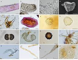 And all your pains will be relieved. Examples Of Foreign Matter Observed In Commercial Yohimbe Samples A C Download Scientific Diagram