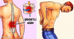 Agrinizi Bicak Gibi Kesen Hareket Sirt Agrisi Kronik Agri Saglik Ve Fitness