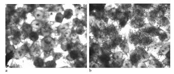 Тем не менее биотехнологам не повезло. First Isolation And Further Characterization Of Enteropathogenic Escherichia Coli Epec O157 H45 Strains From Cattle Bmc Microbiology Full Text