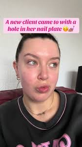 Apart from onycholysis , these are some of the most damaged nails Ive seen  caused by an actual nail tech! #naildamage #nailcare #healthynailscheck  #healthynails #nailtech #nailtechproblems #CapCut