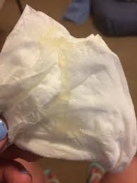 Mucus Plug 101 Who What Where When Why With Photos
