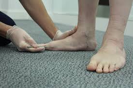 No one is sure why these occur. Plantar Fibroma The Foot Biomechanical Problems What We Treat Chiropody Co Uk Leading Chiropodist Podiatrists In Manchester And Liverpool