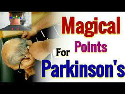 Acupressure Points For Parkinson S Disease Acupressure For Parkinson S Patients Magical Points Youtube