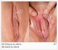 Exciter clitoris