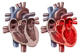 Image result for Cardiomyopathy