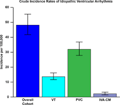 Incidence Of Idiopathic Ventricular Arrhythmias