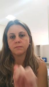 Cuidados diários com a pele✨, Daily skin Care✨, 1° Higienização, 2°  Esfoliação, 3° Tonificação, 4° Finalização ( sérum Vit C), 5° Fotoproteção,  ✨Os cuidados devem começar hoje para que no amanhã não ...