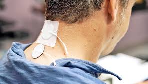 Treatment may restore hand and arm control after spinal injury