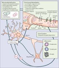 Symptoms differ among people with the disease but generally include Progressive Multiple Sclerosis Prospects For Disease Therapy Repair And Restoration Of Function The Lancet