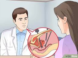 Your total medical expenses must exceed 7.5% of your adjusted gross income (agi) consult your certified public accountant for advice on whether itemizing deductions will lower your costs of getting your tubes untied. How To Get Tied Tubes Untied 15 Steps With Pictures Wikihow