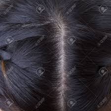Hair dandruff hair scalp grease hairstyles scalp conditions hair growth treatment relaxed hair hair day healthy hair natural hair styles. Black Hair With Dandruff On Head Close Up Image Stock Photo Picture And Royalty Free Image Image 33717019