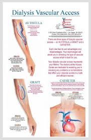 Pin By Tina Coates On Anatomy Art Dialysis Nurse Medical Knowledge Icu Nursing