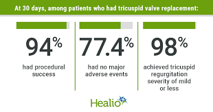 Transcatheter Tricuspid Valve Replacement System Successful At 30 Days