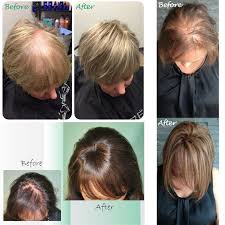 Wigs are a popular choice to hide baldness of any kind, because good ones can be hard to distinguish from hair growing out of the head. Women Hair Topper Hairpiece Human Crown Hair Wigs Toupees For Thinning Loss Hair Ebay