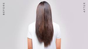 I'm now near the 6th month after surgery. Hair Diaries Before After Grow Gorgeous
