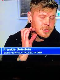 Another perfect example of why I think firearms should not be allowed in  bars