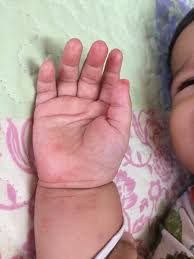 Bahaya nih, takut jangkit dekat syifa pula. Baby Chair Punca Anak Dapat Virus Hfmd Ibu Sila Hati Hati Vanilla Kismis