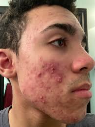 Finding shiny Pokémon at home