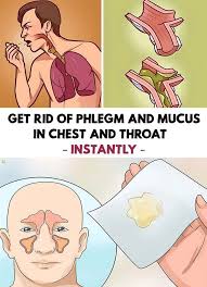 Get Rid Of Phlegm And Mucus In Chest And Throat Instantly Getting Rid Of Phlegm Mucus Getting Rid Of Mucus