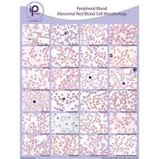 Peripheral Blood Cards And Posters