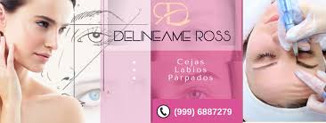 Delíneameross