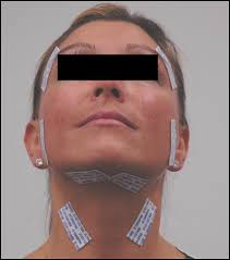 Applying Technology to TMD Diagnosis