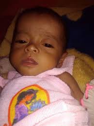 Adek Grace Terkena Virus CMV di Usia 9 Bulan