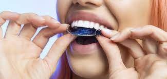 Feb 12, 2021 · the cost for removable clear plastic retainers is $400 to $800 for both arches while a permanent retainer is $500 per arch (lower or upper teeth). How Much Does A Retainer Cost 2021