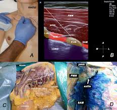 Image result for Axillary Nerve Block