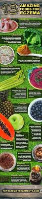 13 Amazing Foods For Eczema Sufferers Eczema Infographic Topeczematreatmen Psoriasis Diet Eczema Diet Eczema