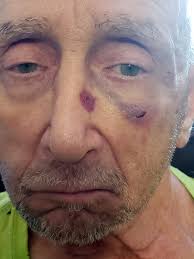 NYPD: Former Anthrax lead singer Dan Nelson beat two elderly men at Queens  hotel