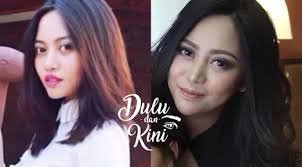 Pada video tersebut, rachel vennya menjelaskan, ia dulu kerap mengalami ledakan emosional. Dulu Dan Kini Transformasi Rachel Vennya Dari Tampilan Aneh Hingga Memesona Beauty Fimela Com