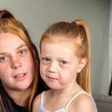 Girl, four, keeps asking if scars are forever after dog left her needing 40  stitches