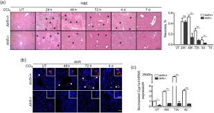 How can i prevent my cat from getting cancer? Dioxin Receptor Adjusts Liver Regeneration After Acute Toxic Injury And Protects Against Liver Carcinogenesis Scientific Reports