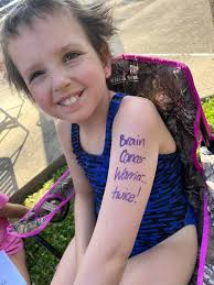 Is radiation normal after triple negative breast cancer chemotherapy?