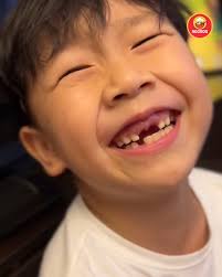 Yoke Foo Lee Wilson Yap，哈哈哈还记得巧克力的故事吗？