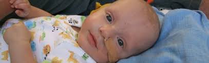 Signs and symptoms of pink eye in infants. Retinoblastoma Treatment Childhood Eye Cancer Trust