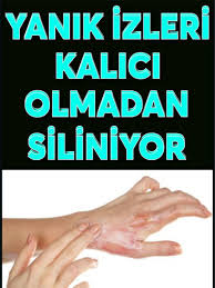 pin on saglik ve guzellik
