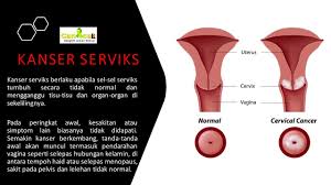 Test, kadının serviksinin yüzeyinden küçük bir hücre örneğini almayı içerir. Kanser Serviks Cancel Cancer Bangkit Lawan Kanser Facebook